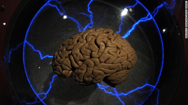 microchip en el cerebro podría ayudar a recuperar la memoria
